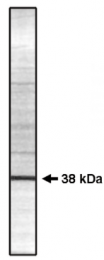 AP05038PU-N - PPP1CC