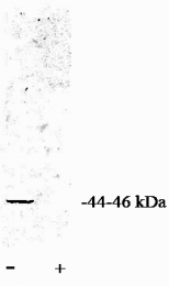 AP05050PU-N - PPP2CA / PPP2CB