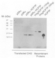 AP05058PU-N - ACP1 / LMW-PTPase