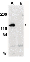 AP05091PU-N - APAF1