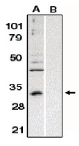 AP05093PU-N - Bcl-10