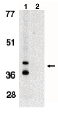 AP05094PU-N - BNIP3L / BNIP3A