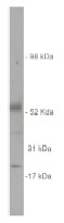 AP05259SU-N - SULF2