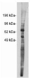 AP05263SU-N - Netrin-1