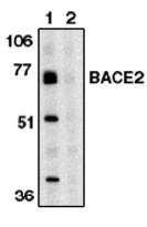 AP05098PU-N - BACE2