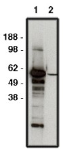AP05288SU-N - FBXW7