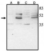 AP05111PU-N - VSX2 / CHX10