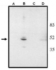 AP05112PU-N - VSX2 / CHX10