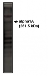 AP05131PU-N - CACNA1A