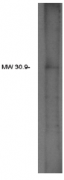 AP05177PU-N - AGPAT2