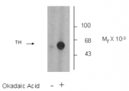 AP05191PU-N - Tyrosine 3-monooxygenase (TH)