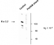 AP05196PU-N - KCNB2