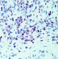 DM278P - MYOD1