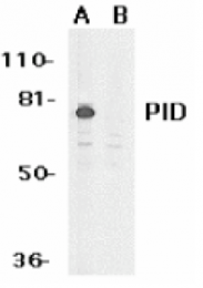 AP05220PU-N - MTA2