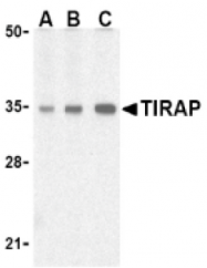 AP05226PU-N - TIRAP