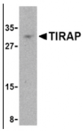 AP05227PU-N - TIRAP