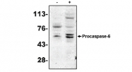 AM05283PU-N - Caspase-6