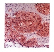 AM05295PU-N - AKR1C2 / DDH2