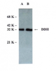 AM05295PU-N - AKR1C2 / DDH2