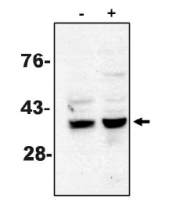AM05296PU-N - Caspase-7