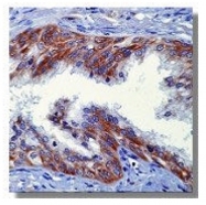 AM05303PU-N - Neuregulin 1