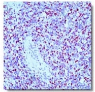 AM05309PU-N - Myogenin