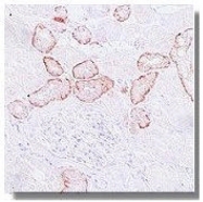 AM05321PU-N - VHL