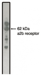 AM05339PU-N - Alpha-2B adrenergic receptor / ADRA2B