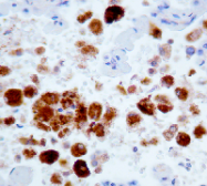 AM03172PU-N - Napsin-A