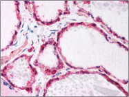 AM06007PU-N - GSTP1 / GST3