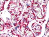 AM06008PU-N - Inhibin alpha / INHA