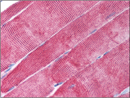 AM06010PU-N - Desmin