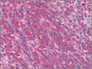 AM06011PU-N - Interleukin-1 alpha / IL-1A