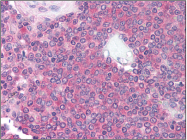 AM06014PU-N - CD10 / Neprilysin
