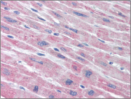 AM06015PU-N - PLA2G5