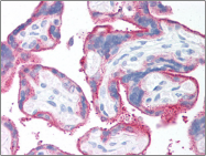 AM06017PU-N - CD59