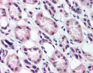 AP07160PU-N - RREB1