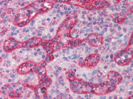 AP07220PU-N - NOS3