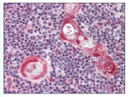 AP07583PU-N - XRCC9 / FANCG
