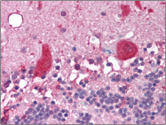 AM06051PU-N - NCOA1