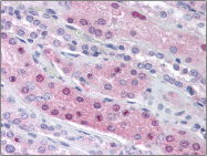AM06052PU-N - NCOA3
