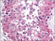 AM06054PU-N - RAD1