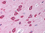 AP07232PU-N - STIM2
