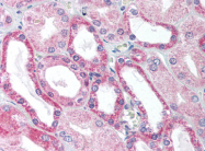 AP07246PU-N - WT1 / Wilms tumor protein