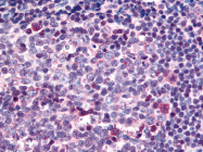 AP07256PU-N - SARM1