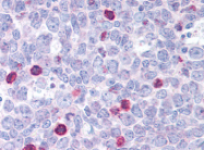 AP07277PU-N - Bax