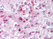 AP07290PU-N - Caspase-6