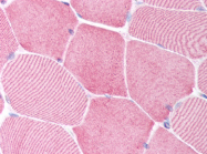 AP07290PU-N - Caspase-6