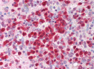 AP07311PU-N - Interleukin-21 / IL21