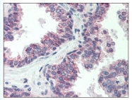 AP07693PU-N - Cerebellin-1